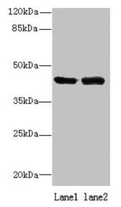 Invitrogen ALS2CR1 Polyclonal Antibody 100 μg; Unconjugated:Antibodies,
