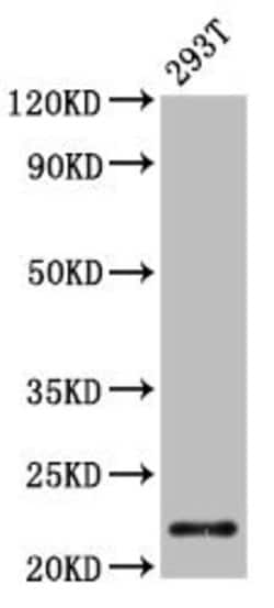Invitrogen CHMP1A Polyclonal Antibody 100 &mu;g; Unconjugated:Antibodies,