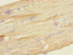 FZD3 Polyclonal Antibody:Antibodies, Polyclonal