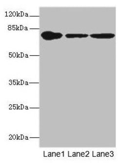 FZD3 Polyclonal Antibody:Antibodies, Polyclonal