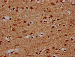 Invitrogen PRDM11 Polyclonal Antibody 100 &mu;g; Unconjugated:Antibodies,