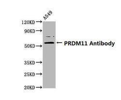 Invitrogen PRDM11 Polyclonal Antibody 100 &mu;g; Unconjugated:Antibodies,