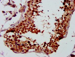 Invitrogen LYAR Polyclonal Antibody 100 &mu;g; Unconjugated:Antibodies,