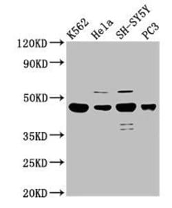 Invitrogen LYAR Polyclonal Antibody 100 &mu;g; Unconjugated:Antibodies,