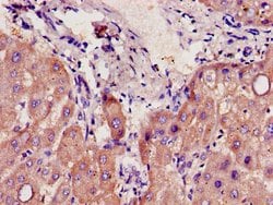 Invitrogen CYP39A1 Polyclonal Antibody 100 &mu;g; Unconjugated:Antibodies,