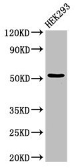 Invitrogen CYP39A1 Polyclonal Antibody 100 &mu;g; Unconjugated:Antibodies,