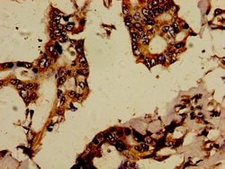 RBPJL Polyclonal Antibody:Antibodies, Polyclonal