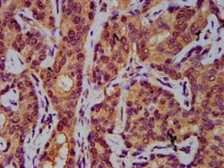 Invitrogen AASS Polyclonal Antibody 100 &mu;g; Unconjugated:Antibodies,