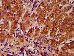 Invitrogen AASS Polyclonal Antibody 100 &mu;g; Unconjugated:Antibodies,