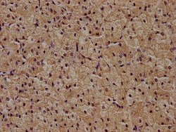 Invitrogen ZRANB1 Polyclonal Antibody 100 &mu;L; Unconjugated:Antibodies,