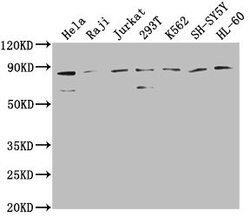 Invitrogen ZRANB1 Polyclonal Antibody 100 &mu;L; Unconjugated:Antibodies,