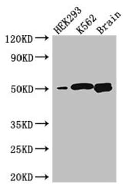 Invitrogen BTNL2 Polyclonal Antibody 100 &mu;g; Unconjugated:Antibodies,
