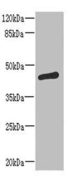 Invitrogen ST6GALNAC2 Polyclonal Antibody 100 &mu;g; Unconjugated:Antibodies,
