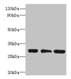 Invitrogen HDHD3 Polyclonal Antibody 100 &mu;g; Unconjugated:Anticuerpos