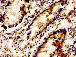 Invitrogen LGR6 Polyclonal Antibody 100 &mu;g | Buy Online | Invitrogen&trade; | Fisher Scientific