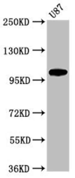 Invitrogen LGR6 Polyclonal Antibody 100 &mu;g | Buy Online | Invitrogen&trade; | Fisher Scientific