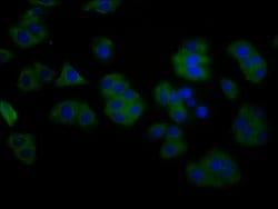 Invitrogen TMEM16B Polyclonal Antibody 100 &mu;g; Unconjugated:Antibodies,