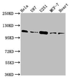 Invitrogen TMEM16B Polyclonal Antibody 100 &mu;g; Unconjugated:Antibodies,