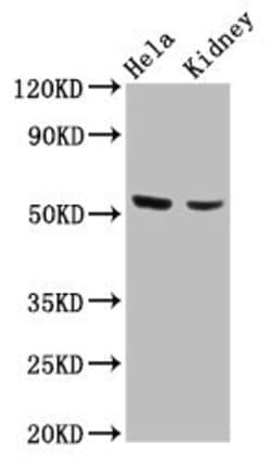 Invitrogen POLK Polyclonal Antibody 100 &mu;g; Unconjugated:Antibodies,