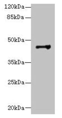 Invitrogen DSCC1 Polyclonal Antibody 100 &mu;g; Unconjugated:Antibodies,