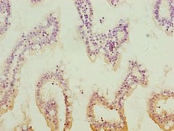 Invitrogen QRSL1 Polyclonal Antibody 100 &mu;L; Unconjugated:Antibodies,