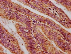 Invitrogen CXorf36 Polyclonal Antibody 100 &mu;g; Unconjugated:Antibodies,