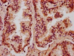 Invitrogen CXorf36 Polyclonal Antibody 100 &mu;g; Unconjugated:Antibodies,