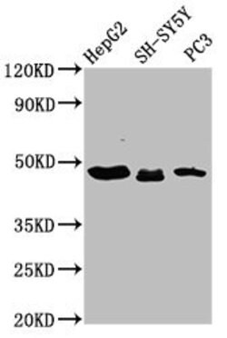 Invitrogen CXorf36 Polyclonal Antibody 100 &mu;g; Unconjugated:Antibodies,