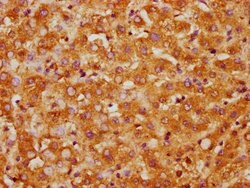 CK1 gamma-1 Polyclonal Antibody 100 &mu;g | Buy Online | Thermo Scientific | Fisher Scientific