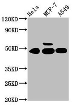 CK1 gamma-1 Polyclonal Antibody 100 &mu;g | Buy Online | Thermo Scientific | Fisher Scientific