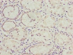 NLE1 Polyclonal Antibody:Antibodies, Polyclonal