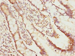 NLE1 Polyclonal Antibody:Antibodies, Polyclonal