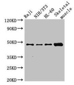 Invitrogen RBM22 Polyclonal Antibody 100 &mu;g; Unconjugated:Antibodies,