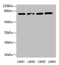 Invitrogen TBC1D14 Polyclonal Antibody 100 &mu;g; Unconjugated:Antibodies,