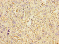 Invitrogen ASIC3 Polyclonal Antibody 100 &mu;L; Unconjugated:Antibodies,