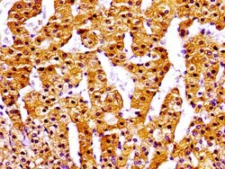 NPC1 Polyclonal Antibody, Invitrogen 100 &mu;g; Unconjugated:Antibodies,