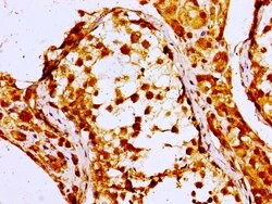NPC1 Polyclonal Antibody, Invitrogen 100 &mu;g; Unconjugated:Antibodies,