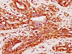Invitrogen PACSIN2 Polyclonal Antibody 100 &mu;g; Unconjugated:Antibodies,