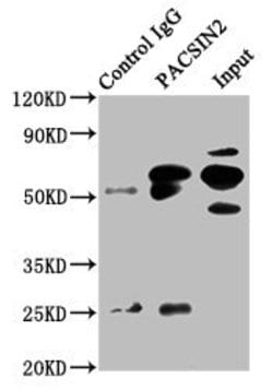 Invitrogen PACSIN2 Polyclonal Antibody 100 &mu;g; Unconjugated:Antibodies,