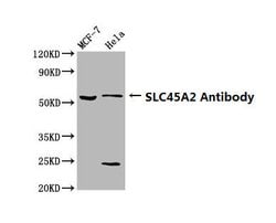 Invitrogen SLC45A2 Polyclonal Antibody 100 &mu;g; Unconjugated:Antibodies,