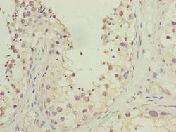 Invitrogen HOOK1 Polyclonal Antibody 100 &mu;g; Unconjugated:Antibodies,