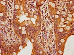 Invitrogen FBXW11 Polyclonal Antibody 100 &mu;L; Unconjugated:Antibodies,