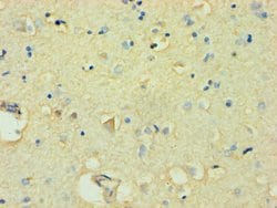 Invitrogen FBXW11 Polyclonal Antibody 100 &mu;L; Unconjugated:Antibodies,
