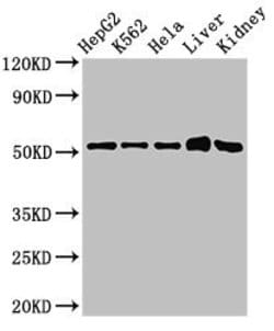 Invitrogen FBXW2 Polyclonal Antibody 100 &mu;g; Unconjugated:Antibodies,