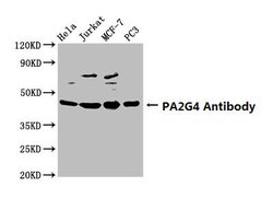 Invitrogen EBP1 Polyclonal Antibody 100 &mu;g; Unconjugated:Antibodies,