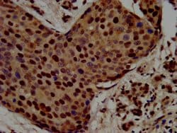 Invitrogen RALY Polyclonal Antibody 100 &mu;g; Unconjugated:Antibodies,