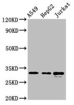 Invitrogen RALY Polyclonal Antibody 100 &mu;g; Unconjugated:Antibodies,