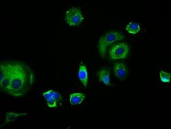 Invitrogen EDAR Polyclonal Antibody 100 &mu;g; Unconjugated:Antibodies,