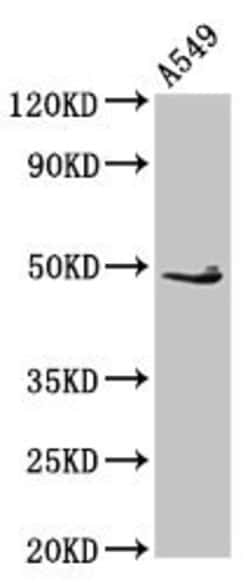 Invitrogen EDAR Polyclonal Antibody 100 &mu;g; Unconjugated:Antibodies,