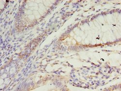 Invitrogen SSR3 Polyclonal Antibody 100 &mu;g | Buy Online | Invitrogen&trade; | Fisher Scientific